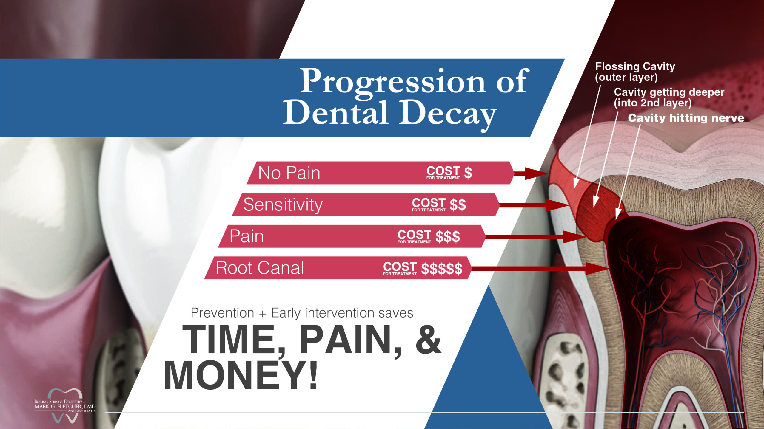 Tooth Pain Diagram